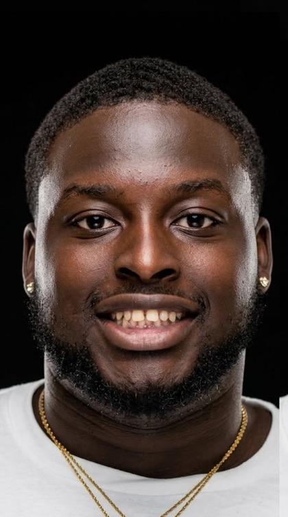 Before veneers